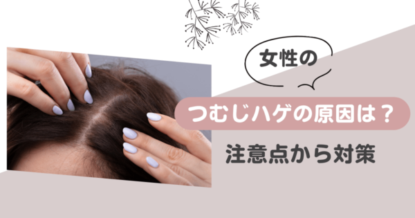 女性がつむじハゲになる原因とは？注意点から対策までわかりやすく解説