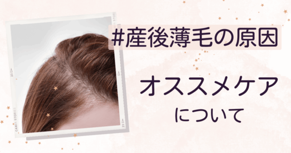 産後のハゲはなぜ起きる?髪悩みを解決する方法&おすすめケアについて